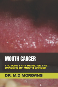 Mouth Cancer