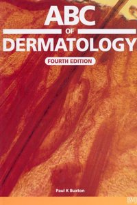 ABC of Dermatology: with CDâ€“ROM (ABC Series)