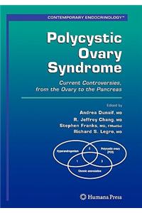 Polycystic Ovary Syndrome