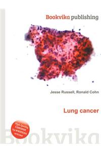 Lung Cancer