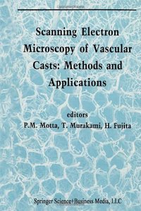 Scanning Electron Microscopy of Vascular Casts