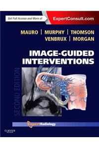 Image-Guided Interventions E-Book