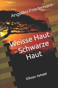 Weisse Haut - Schwarze Haut