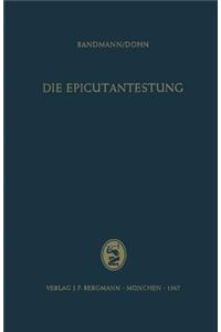 Epicutantestung