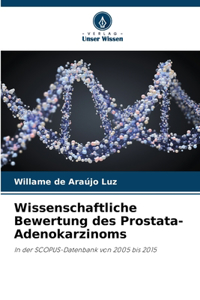 Wissenschaftliche Bewertung des Prostata-Adenokarzinoms