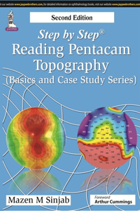 Step by Step: Reading Pentacam Topography