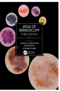 Atlas of Dermoscopy