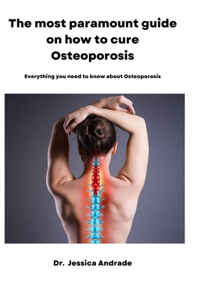 most paramount guide on how to cure Osteoporosis