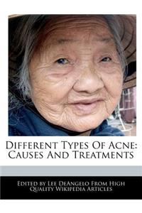 Different Types of Acne