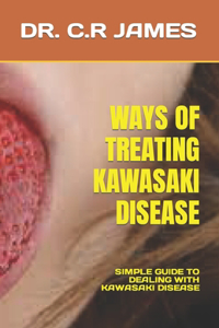 Ways of Treating Kawasaki Disease