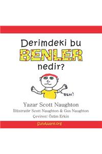 Derimdeki Bu Benler Nedir?