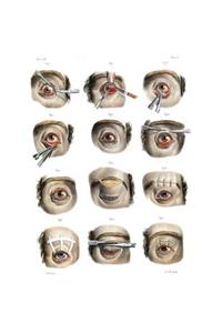 Corrective Eye Surgery for the Treatment of Blepharoptosis and Ectropion Composition Notebook