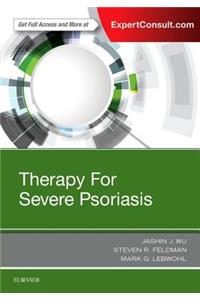 Therapy for Severe Psoriasis