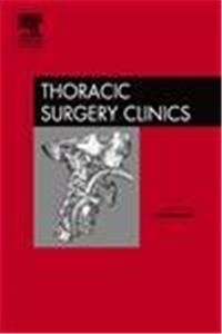 Preoperative Preparation of Patients  for Thoracic Surgery, An Issue of Thoracic Surgery Clinics (The Clinics: Surgery)