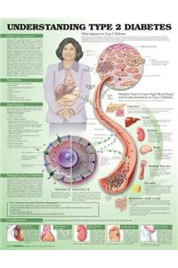 Understanding Type 2 Diabetes Anatomical Chart