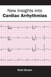 New Insights Into Cardiac Arrhythmias