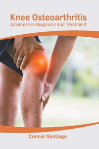 Knee Osteoarthritis: Advances in Diagnosis and Treatment