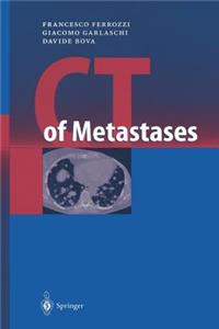 CT of Metastases