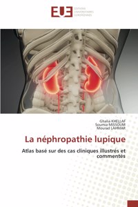 néphropathie lupique