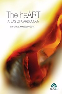 The Heart: Atlas Of Cardiology (Hb 2013)
