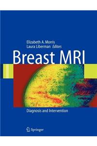 Breast MRI: Diagnosis and Intervention