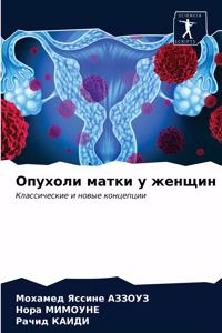 Опухоли матки у женщин