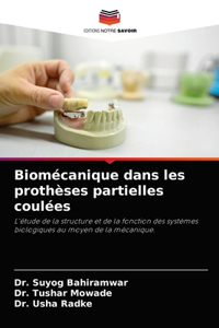 Biomécanique dans les prothèses partielles coulées