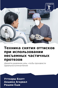 Техника снятия оттисков при использовани