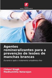 Agentes remineralizantes para a prevenção de lesões de manchas brancas
