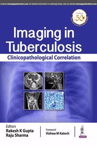 Imaging in Tuberculosis