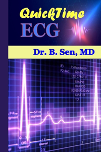 QUICKtime ECG