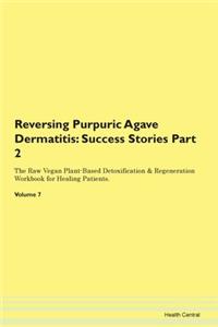 Reversing Purpuric Agave Dermatitis: Suc