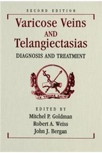 Varicose Veins and Telangiectasias: Diagnosis and Treatment, Second Edition