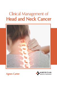 Clinical Management of Head and Neck Cancer