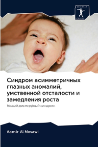Синдром асимметричных глазных аномалий, у