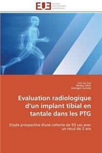 Evaluation Radiologique D Un Implant Tibial En Tantale Dans Les Ptg