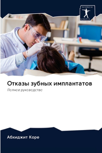 Отказы зубных имплантатов
