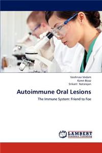 Autoimmune Oral Lesions