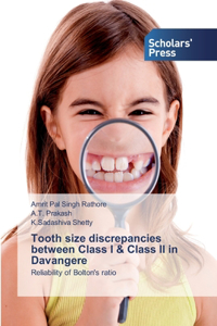 Tooth size discrepancies between Class I & Class II in Davangere