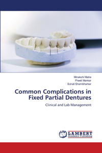 Common Complications in Fixed Partial Dentures