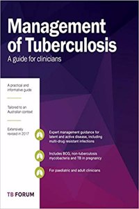 Management of Tuberculosis