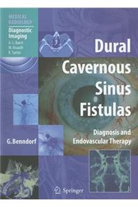 Dural Cavernous Sinus Fistulas: Diagnosis and Endovascular Therapy