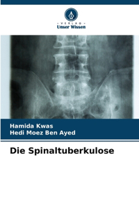 Spinaltuberkulose