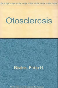 Otosclerosis