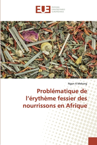 Problématique de l'érythème fessier des nourrissons en Afrique