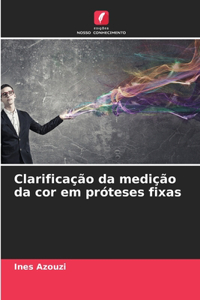 Clarificação da medição da cor em próteses fixas