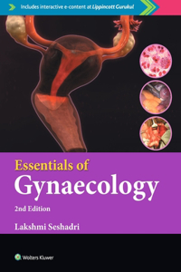 Essentials of Gynaecology, 2/e