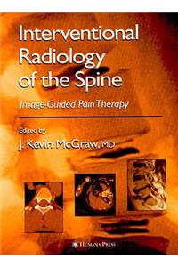 Interventional Radiology of the Spine