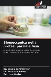 Biomeccanica nella protesi parziale fusa