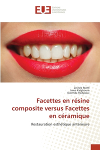 Facettes en résine composite versus Facettes en céramique